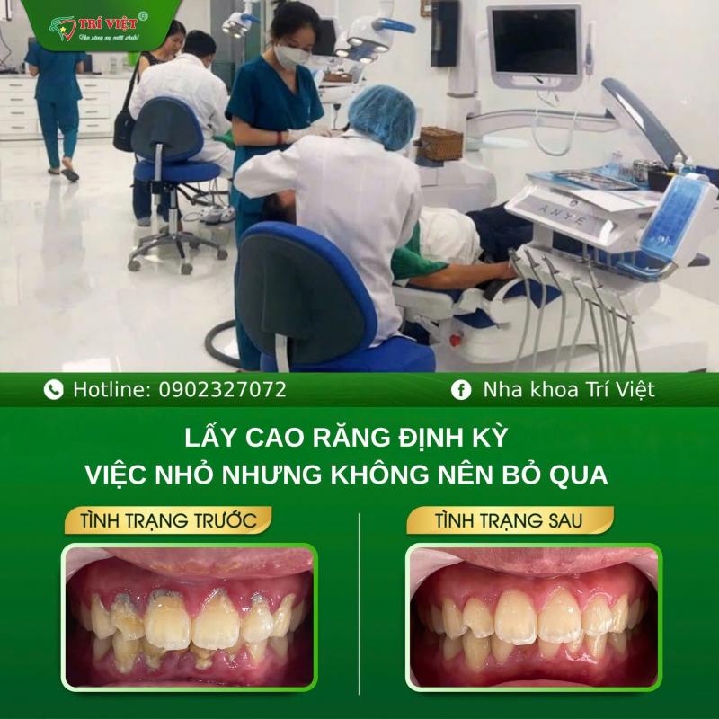 Nha Khoa Trí Việt