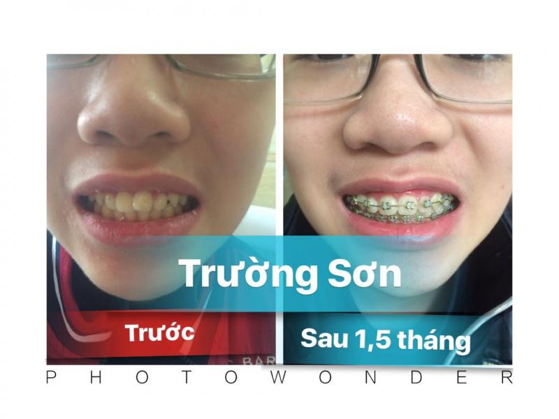 Nha Khoa Trường Sơn