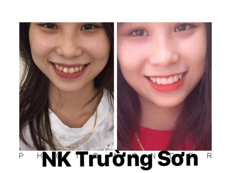 Nha Khoa Trường Sơn