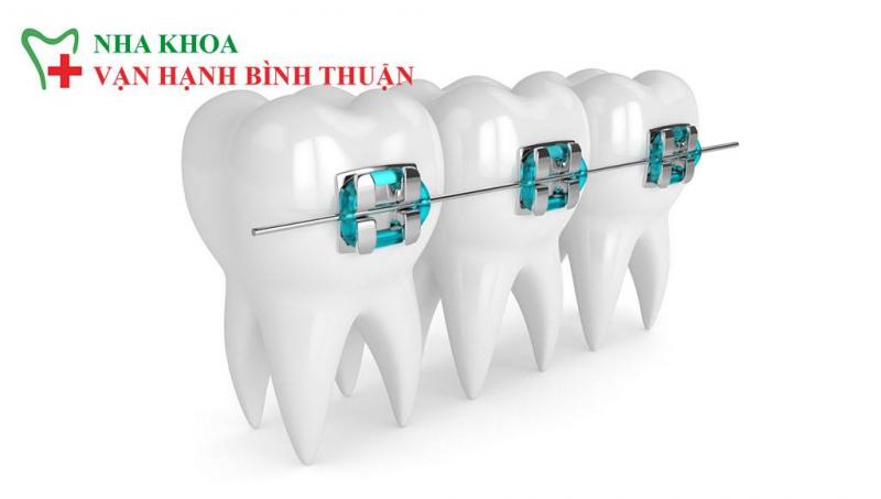 Nha Khoa Vạn Hạnh Bình Thuận