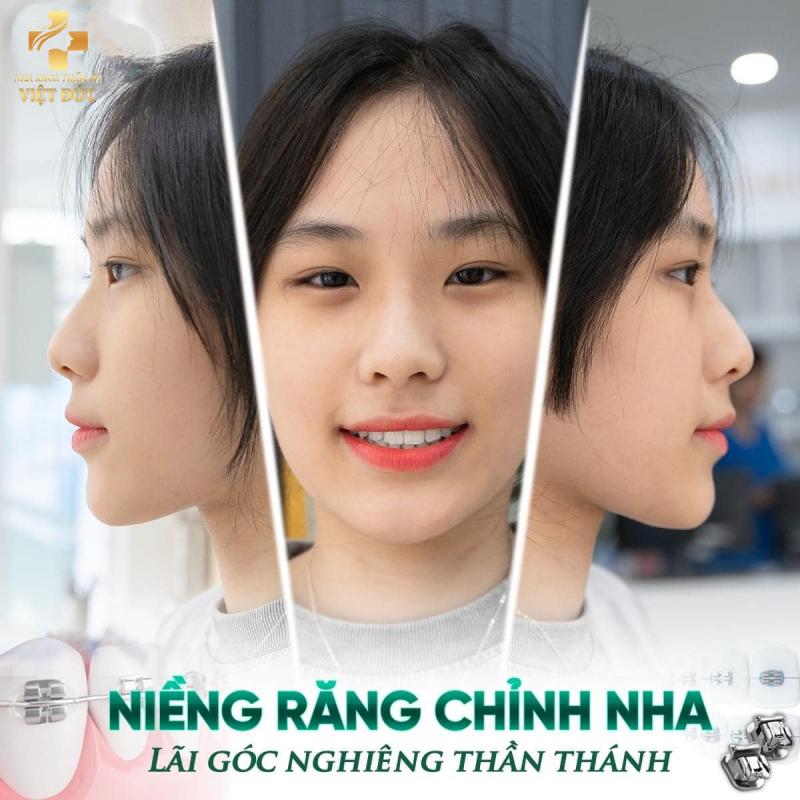 Nha Khoa Việt Đức