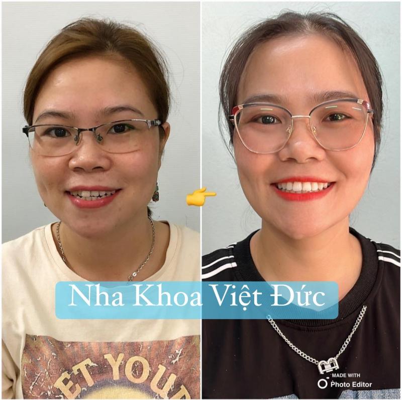 Nha khoa Việt Đức