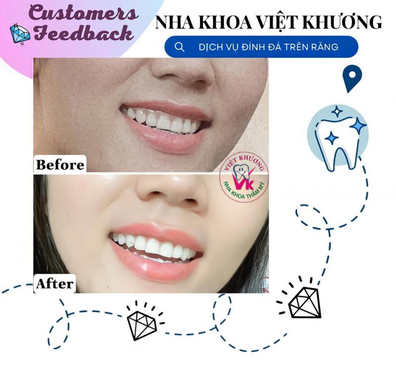 Nha khoa Việt Khương