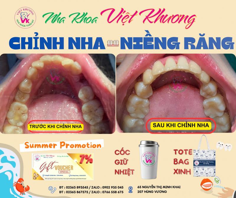 Nha khoa Việt Khương