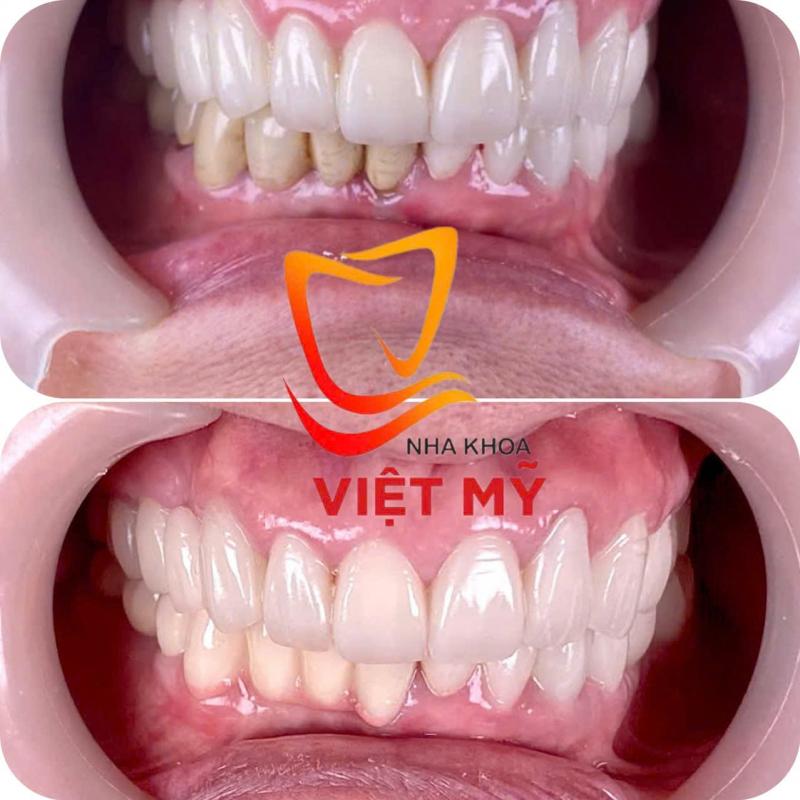 Nha Khoa Việt Mỹ