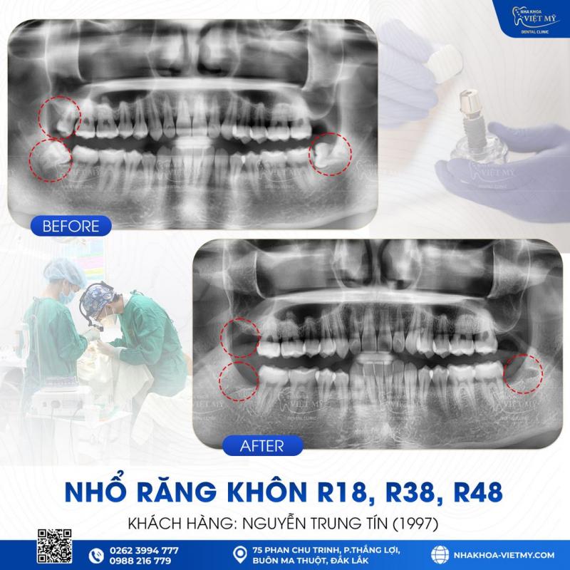 Nha khoa Việt Mỹ - chi nhánh Đắk Lắk