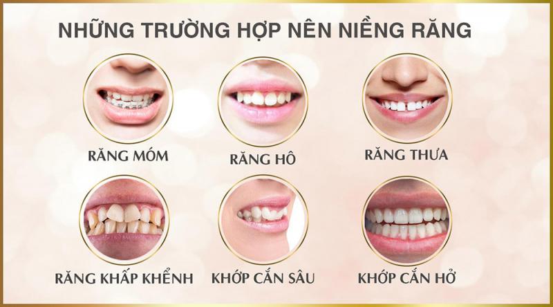 Nha Khoa Việt Pháp