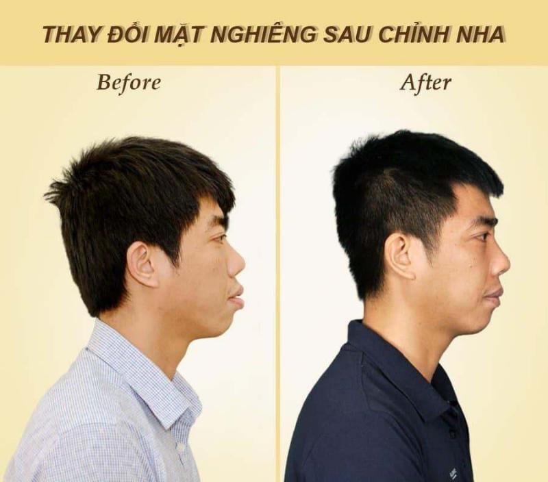 Nha khoa Việt Pháp