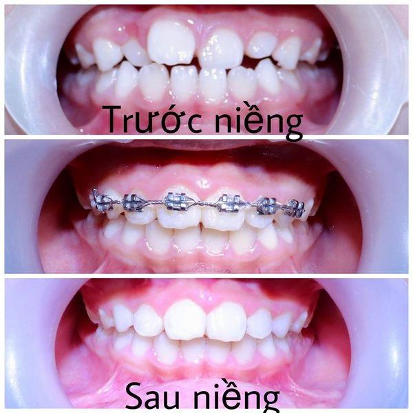 Nha Khoa Việt Pháp Cần Thơ