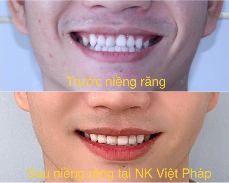Nha Khoa Việt Pháp Cần Thơ
