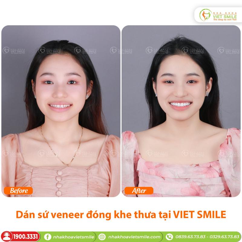 Nha Khoa VIET SMILE