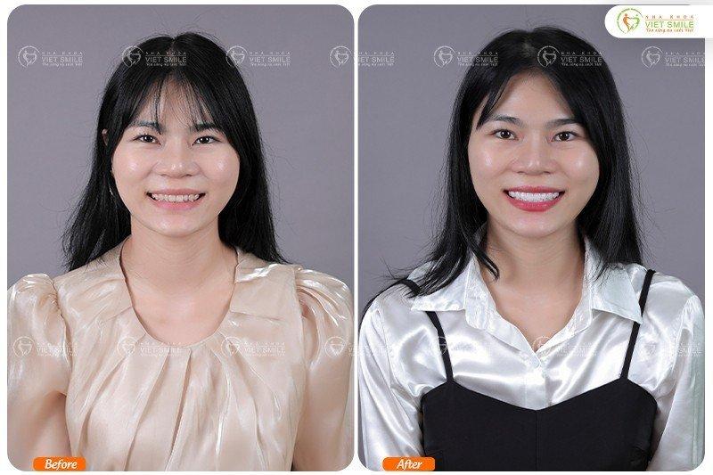 Nha khoa VIET SMILE