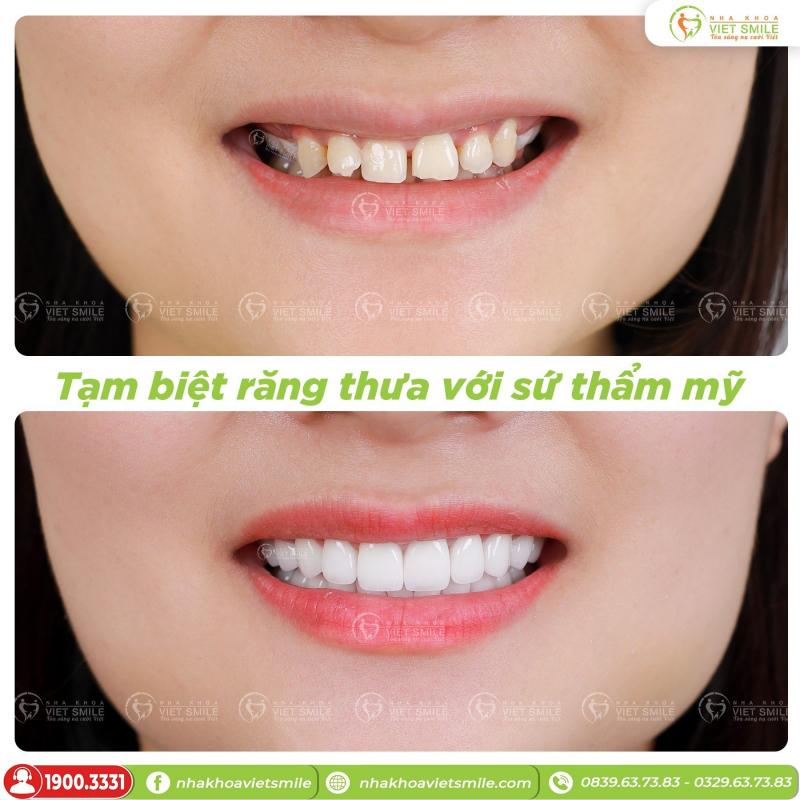 Nha khoa VIET SMILE