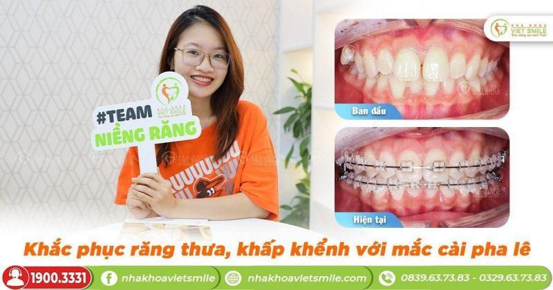 Nha khoa Việt Smile