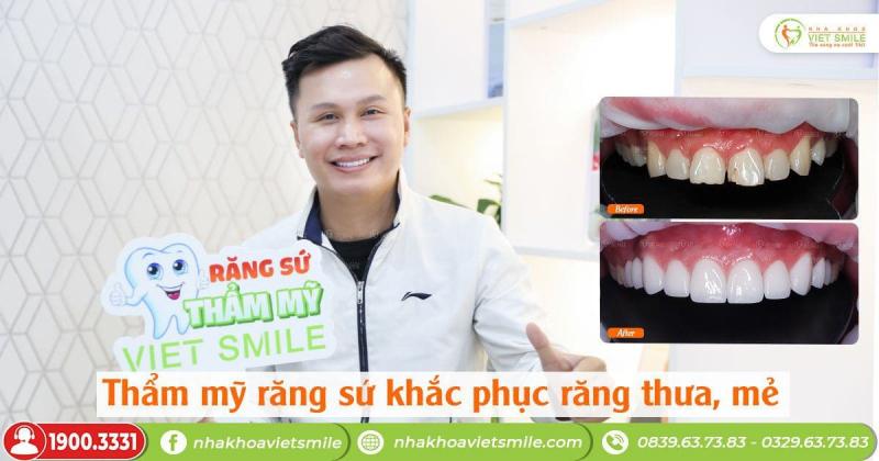Nha khoa VIET SMILE