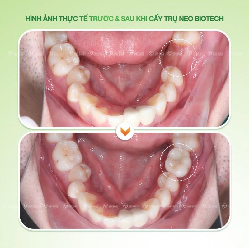 Nha khoa VIET SMILE