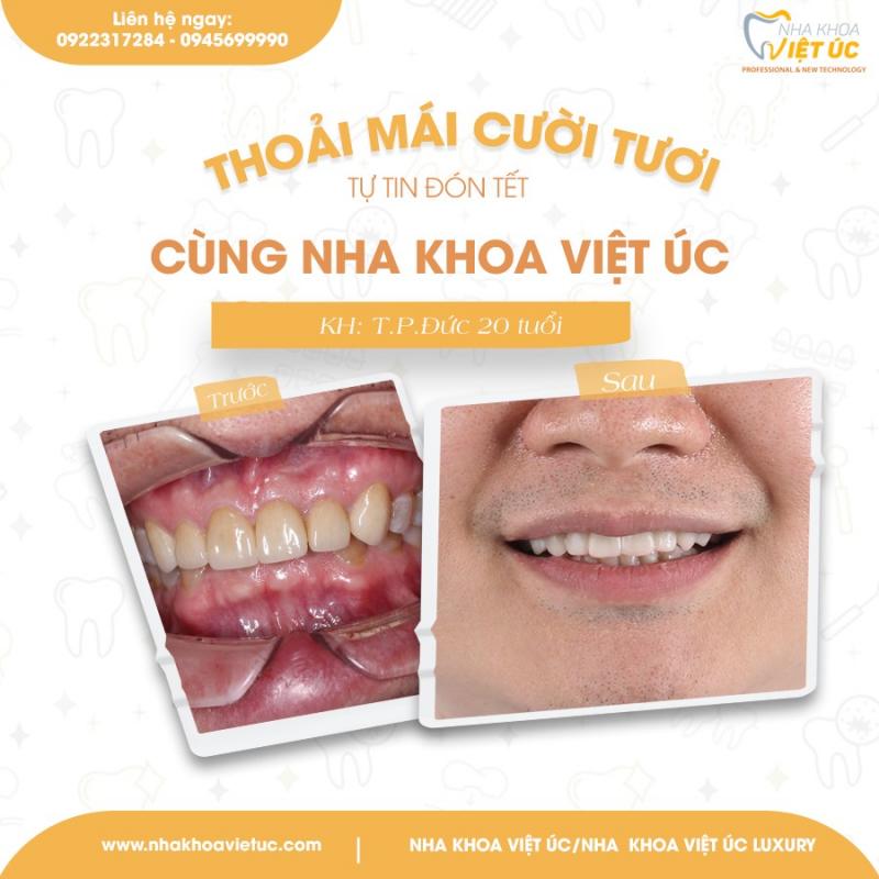 Nha khoa Việt Úc