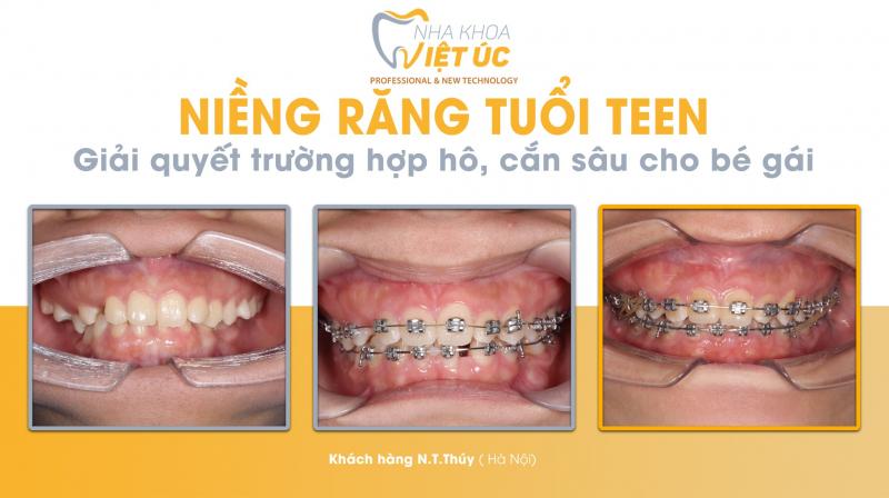 Nha khoa Việt Úc