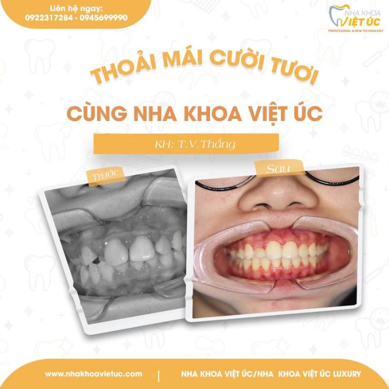 Nha khoa Việt Úc