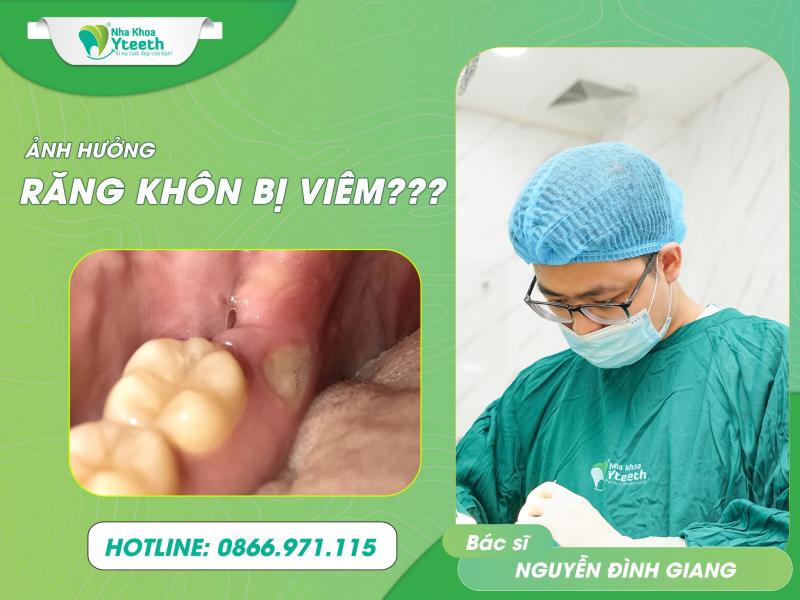 Nha khoa Yteeth