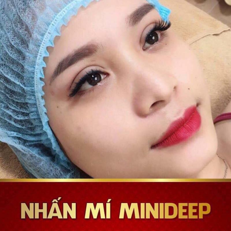 Nhấn mí Hồ Ly