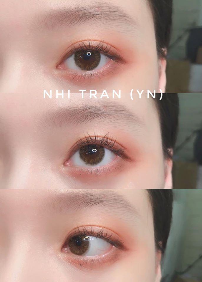 Nhi Tran Contact Lens