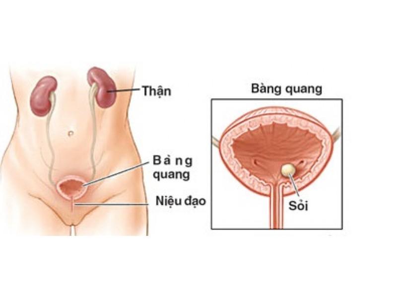 Nhiễm khuẩn đường tiết niệu