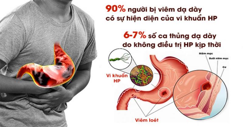 Nhiễm vi khuẩn Hp dạ dày