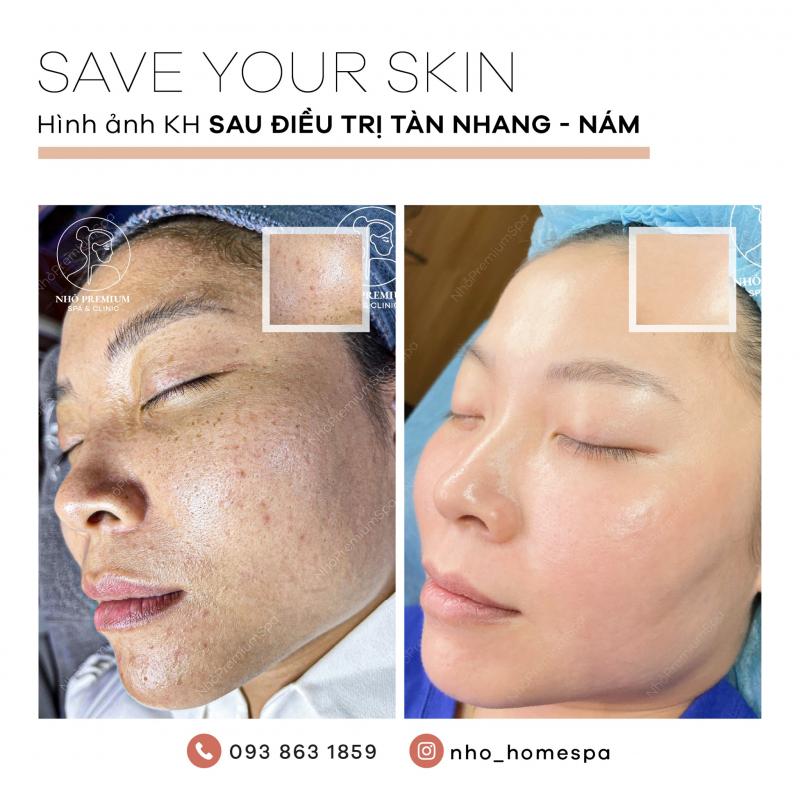 Nhỏ Premium Spa