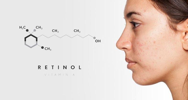 Những ai không nên sử dụng Retinol?