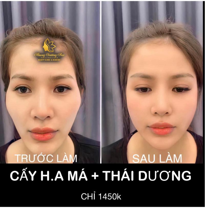 Nhung Trường Mai Beauty & Spa