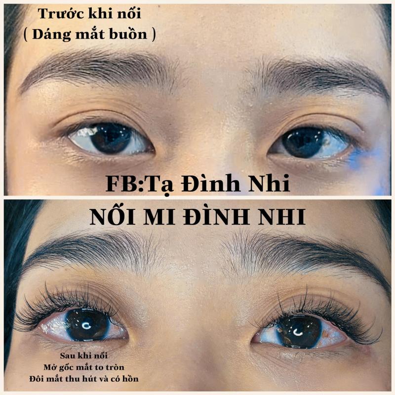 Nối Mi Đình Nhi