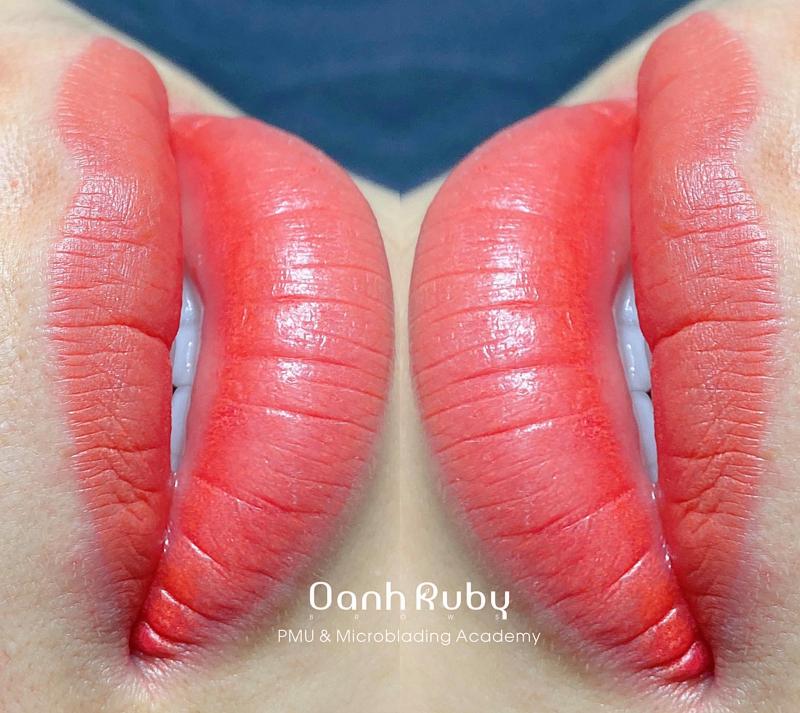 Oanh Ruby - Viện Thẩm Mỹ Công Nghệ Cao