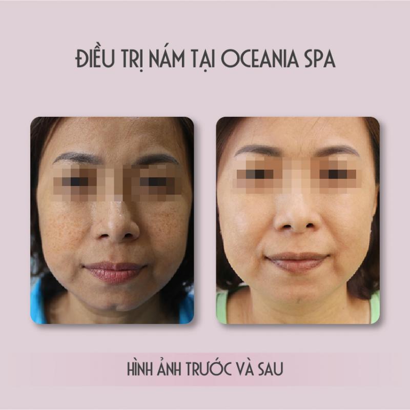 Oceania Spa & Clinic