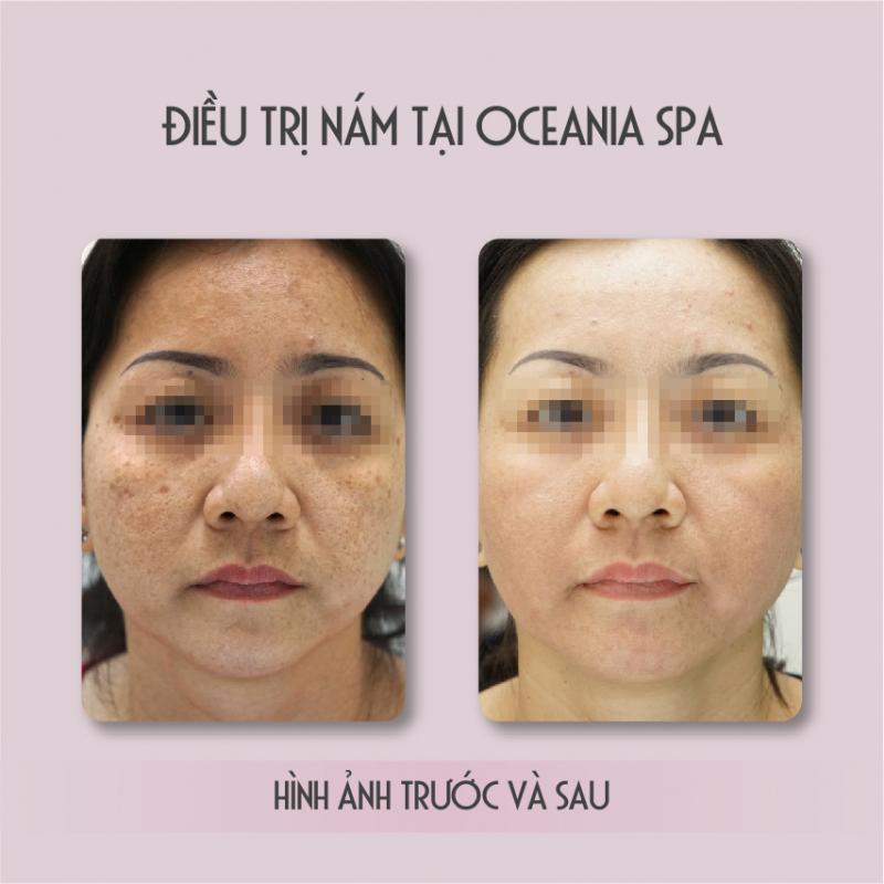 Oceania Spa & Clinic