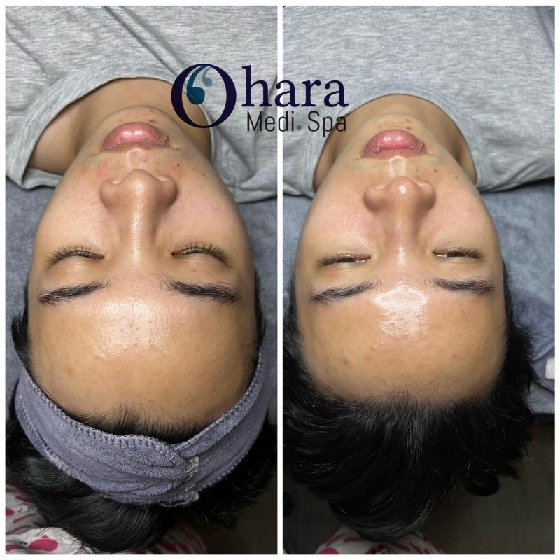 Ohara Beauty Spa - Nha Trang