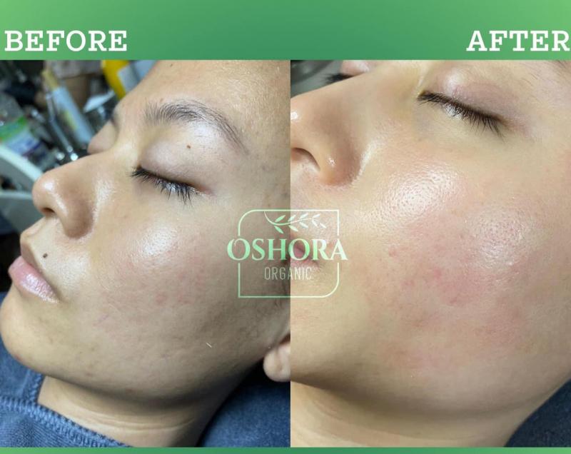 Oshora Organic Clinic & Spa