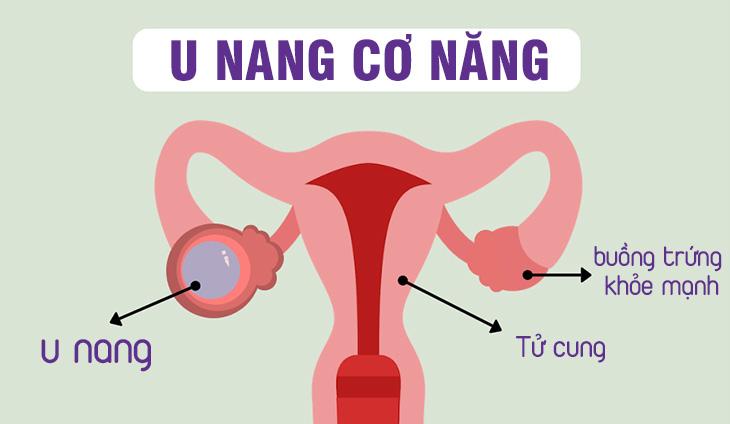 U nang cơ năng