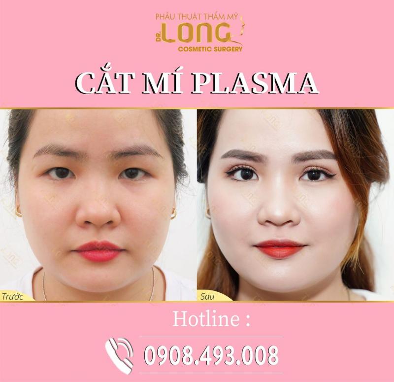 Phẫu Thuật Thẩm Mỹ Bác Sĩ Long