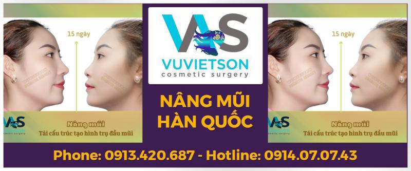 Phẫu thuật thẩm mỹ BS Vũ Viết Sơn