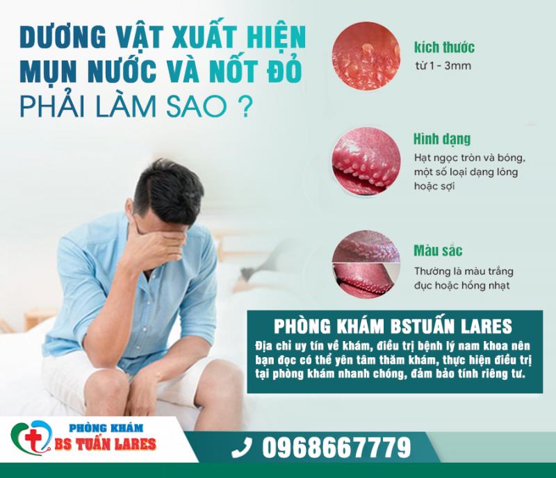 Phòng Khám Bs Tuấn Lares