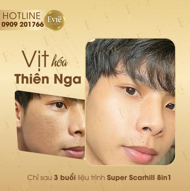 Phòng khám Chuyên khoa Da liễu Evie Clinic & Spa