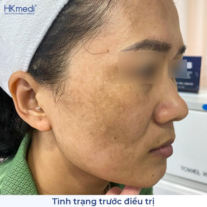 Phòng Khám Chuyên Khoa Da Liễu HKmedi