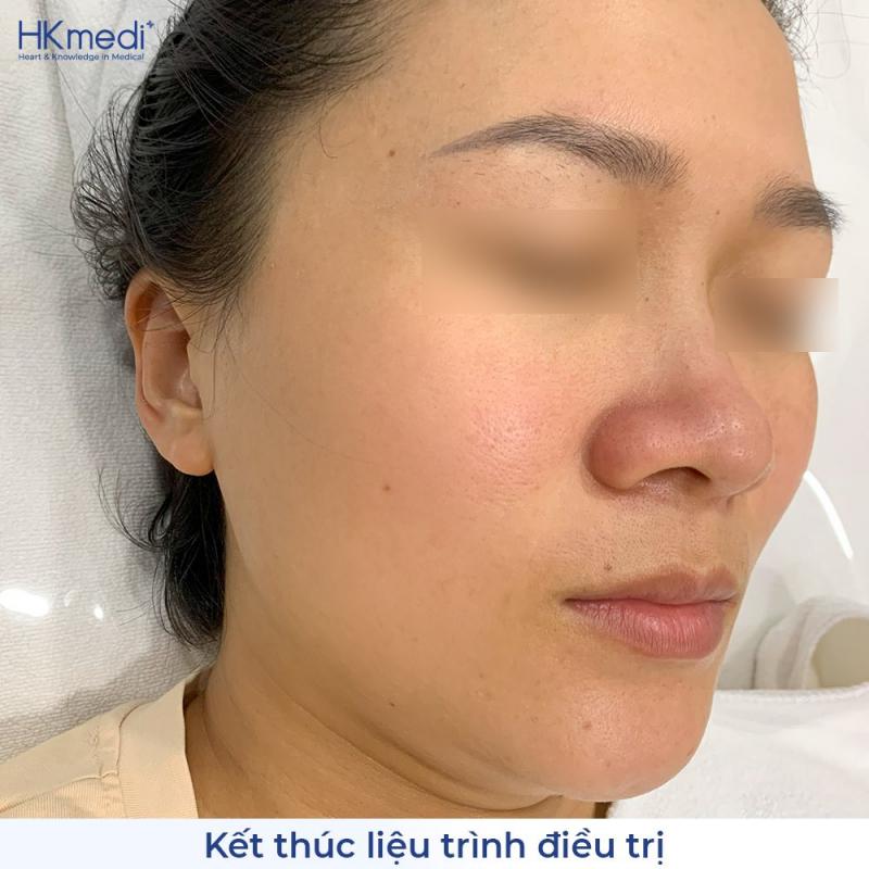 Phòng Khám Chuyên Khoa Da Liễu HKmedi