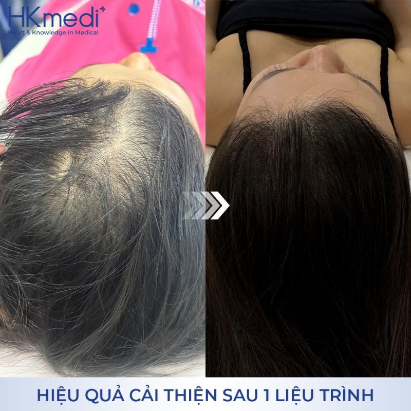 Phòng Khám Chuyên Khoa Da Liễu HKmedi