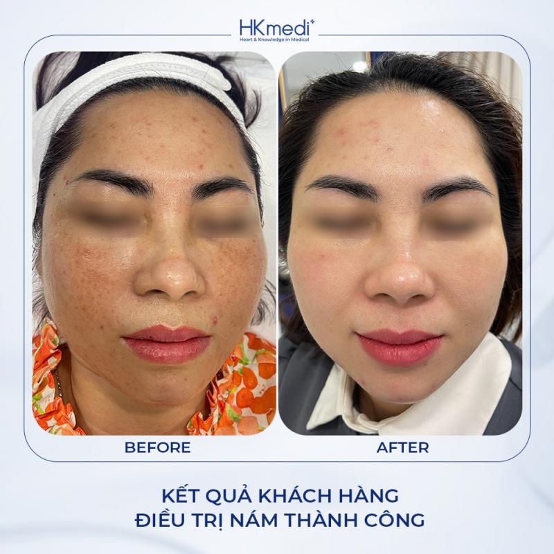 Phòng Khám Chuyên Khoa Da Liễu HKmedi