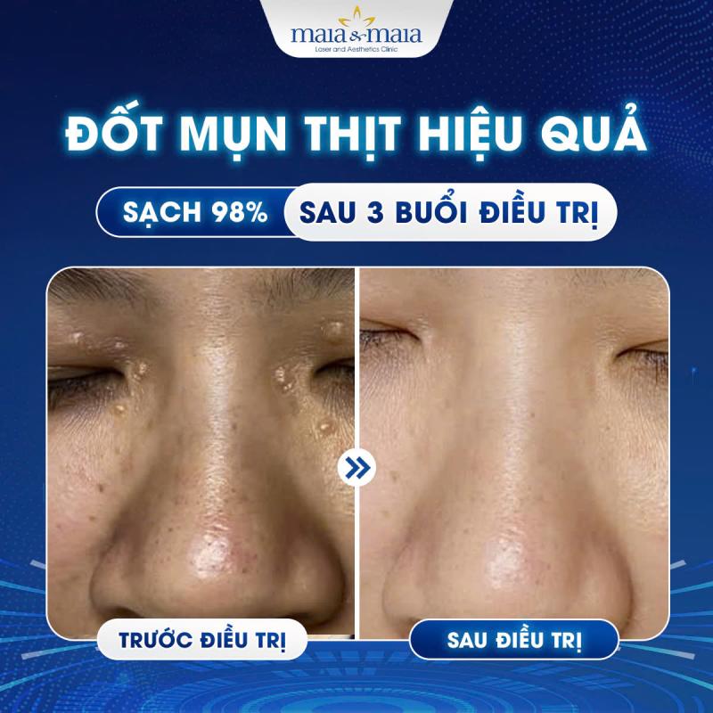 Phòng Khám Chuyên Khoa Da Liễu Maia&Maia