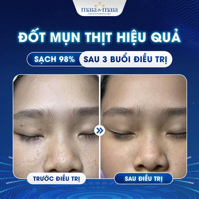 Phòng Khám Chuyên Khoa Da Liễu Maia&Maia