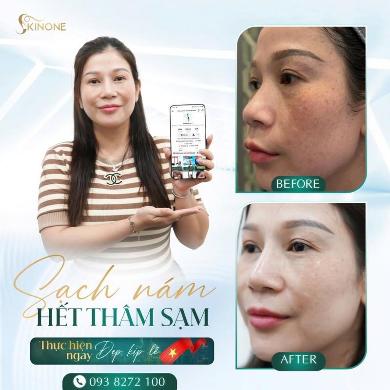 Phòng khám chuyên khoa da liễu SkinOne