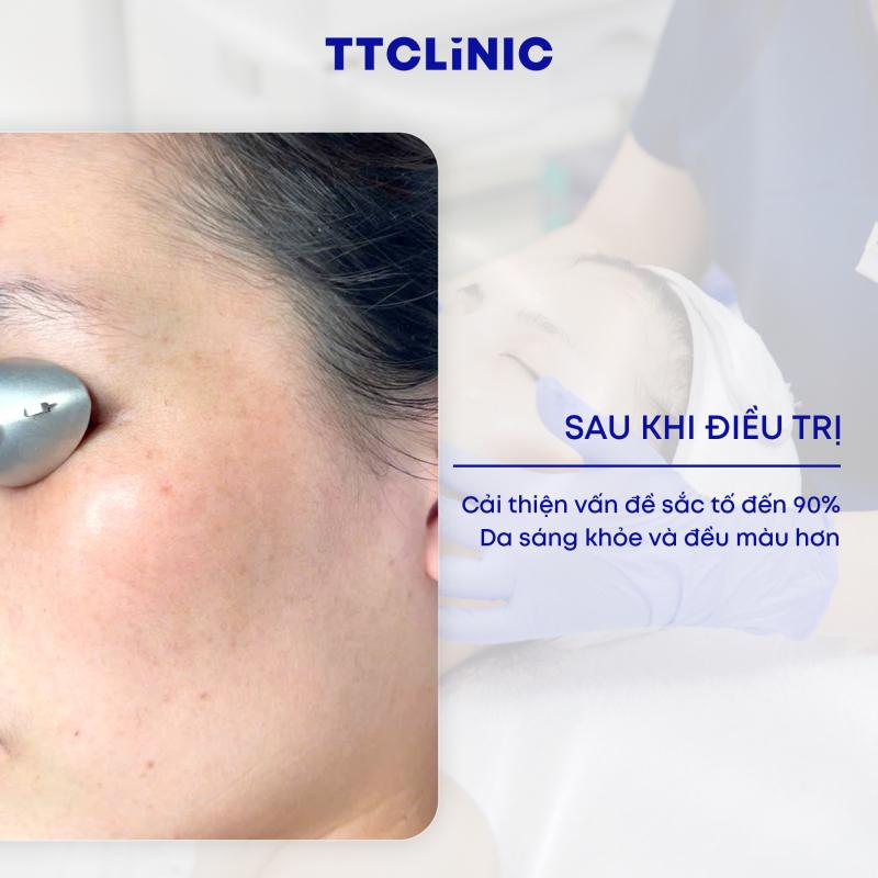 Phòng Khám Chuyên Khoa Da Liễu Thẩm Mỹ - TTCLiNIC